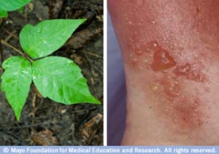 Poison Ivy Control